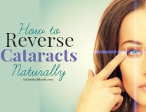 L-Carnosine is a non-surgical option for cataracts