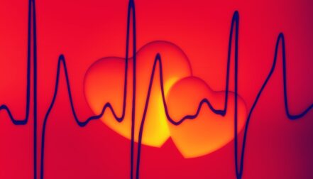 high blood pressure variability