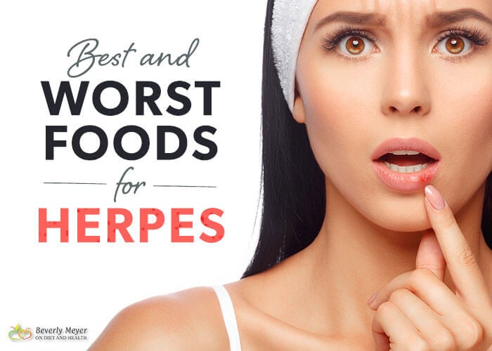 Herpes Diet Chart