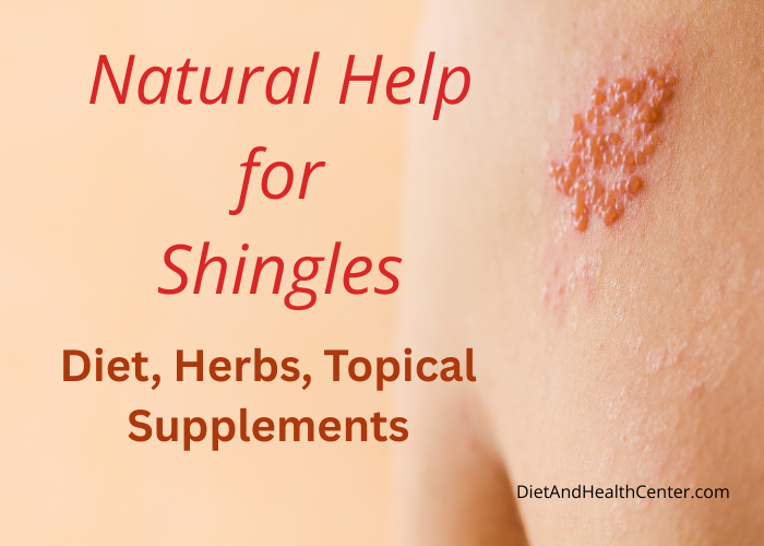 Shingles rash on the shoulder